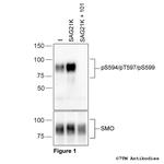 Phospho-SMO Receptor (Ser594, Thr597, Ser599) Polyclonal Antibody