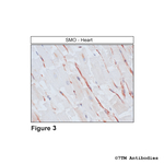 SMO, Smoothened Receptor Antibody in Immunohistochemistry (Paraffin) (IHC (P))