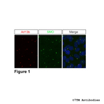 SMO, Smoothened Receptor Antibody in Immunohistochemistry (Paraffin) (IHC (P))