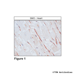 SMO, Smoothened Receptor Antibody in Immunohistochemistry (Paraffin) (IHC (P))