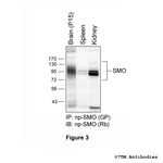 SMO, Smoothened Receptor Antibody in Western Blot (WB)