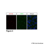 SMO, Smoothened Receptor Antibody in Immunohistochemistry (Paraffin) (IHC (P))