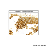 GHRHR (GHRH Receptor) Antibody in Immunohistochemistry (Paraffin) (IHC (P))