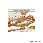 GHRHR (GHRH Receptor) Antibody in Immunohistochemistry (Paraffin) (IHC (P))