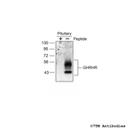 GHRHR (GHRH Receptor) Antibody in Western Blot (WB)