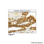 GHRHR, GHRH Receptor Polyclonal Antibody
