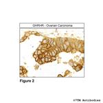 GHRHR, GHRH Receptor Antibody in Immunohistochemistry (Paraffin) (IHC (P))