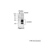 GHRHR, GHRH Receptor Antibody in Western Blot (WB)