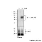 Phospho-Gastric Inhibitory Polypeptide Receptor (Thr442, Ser443) Polyclonal Antibody