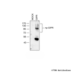 GIPR Gastric Inhibitory Polypeptide Receptor Polyclonal Antibody