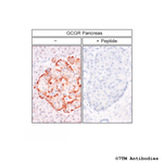 GCGR, Glucagon Receptor Antibody in Immunohistochemistry (Paraffin) (IHC (P))