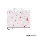 SCTR, Secretin Receptor Antibody in Immunohistochemistry (Paraffin) (IHC (P))