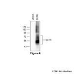 SCTR, Secretin Receptor Antibody in Western Blot (WB)