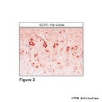 SCTR, Secretin Receptor Antibody in Immunohistochemistry (Paraffin) (IHC (P))