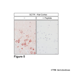 SCTR, Secretin Receptor Polyclonal Antibody