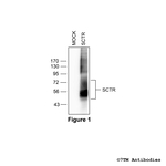 SCTR, Secretin Receptor Antibody in Western Blot (WB)