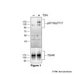 Phospho-Thyrotropin Receptor (Ser716, Thr717) Antibody in Western Blot (WB)