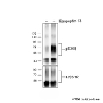 Phospho-Kisspeptin Receptor (Ser368) Polyclonal Antibody