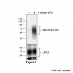 Phospho-Lysophosphatidic Acid Receptor 2 (Ser331, Thr332) Polyclonal Antibody
