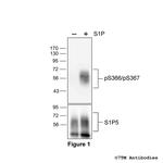 Phospho-Sphingosine 1-Phosphate Receptor 5 (Ser366, Ser367) Polyclonal Antibody