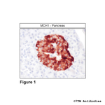 MCH1 Melanin-Concentrating Hormone Receptor 1 Antibody in Immunohistochemistry (Paraffin) (IHC (P))