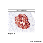 MCH1, Melanin-Concentrating Hormone Receptor 1 Antibody in Immunohistochemistry (Paraffin) (IHC (P))