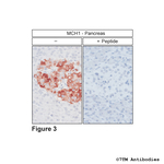 MCH1, Melanin-Concentrating Hormone Receptor 1 Polyclonal Antibody