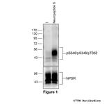 Phospho-NPS Receptor (Ser346, Ser349, Thr352) Antibody in Western Blot (WB)