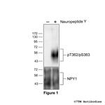 Phospho-Neuropeptide Y Receptor 1 (Thr362, Ser363) Polyclonal Antibody