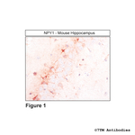 NPY1, Neuropeptide Y Receptor 1 Antibody in Immunohistochemistry (Paraffin) (IHC (P))