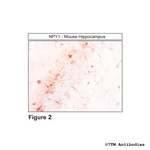 NPY1, Neuropeptide Y Receptor 1 Antibody in Immunohistochemistry (Paraffin) (IHC (P))