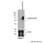 Phospho-Neurotensin Receptor 1 (Ser403, Ser404) Antibody in Western Blot (WB)