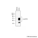 NTS1, Neurotensin Receptor 1 Antibody in Western Blot (WB)