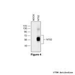 NTS2, Neurotensin Receptor 2 Antibody in Western Blot (WB)