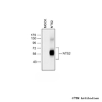 NTS2 (Neurotensin Receptor 2) Antibody in Western Blot (WB)