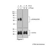 Phospho-Atypical Chemokine Receptor 2 (Ser348, Ser350) Polyclonal Antibody