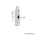 ACKR2, Atypical Chemokine Receptor 2 Polyclonal Antibody