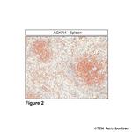 ACKR4, Atypical Chemokine Receptor 4 Antibody in Immunohistochemistry (Paraffin) (IHC (P))