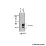 ACKR4, Atypical Chemokine Receptor 4 Antibody in Western Blot (WB)