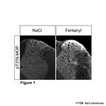 Phospho-mu-Opioid Receptor (Thr376) Polyclonal Antibody