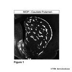 MOP, mu-Opioid Receptor Polyclonal Antibody