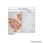 OX2 Orexin Receptor 2 Polyclonal Antibody