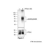 Phospho-Parathyroid Hormone Receptor 1 (Ser493, Ser495) Antibody in Western Blot (WB)