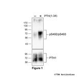 Phospho-Parathyroid Hormone Receptor 1 (Ser492, Ser493) Antibody in Western Blot (WB)