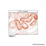 PTH1, Parathyroid Hormone Receptor 1 Polyclonal Antibody