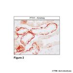 PTH1, Parathyroid Hormone Receptor 1 Antibody in Immunohistochemistry (Paraffin) (IHC (P))