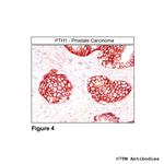 PTH1 (Parathyroid Hormone Receptor 1) Antibody in Immunohistochemistry (Paraffin) (IHC (P))