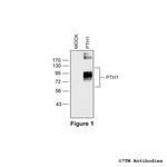 PTH1 (Parathyroid Hormone Receptor 1) Polyclonal Antibody