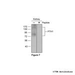 PTH1 (Parathyroid Hormone Receptor 1) Antibody in Western Blot (WB)
