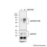 Phospho-QRFP Receptor (Ser365, Thr368) Polyclonal Antibody